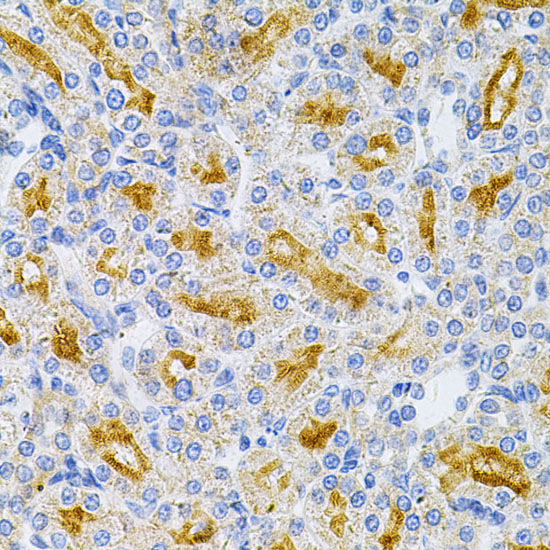 Immunohistochemistry of paraffin-embedded Rat kidney using MYD88 Polyclonal Antibody at dilution of  1:100 (40x lens).