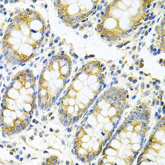 Immunohistochemistry of paraffin-embedded Human colon using MYD88 Polyclonal Antibody at dilution of  1:100 (40x lens).