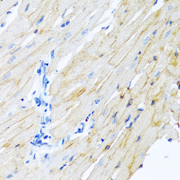 Immunohistochemistry of paraffin-embedded Rat heart using ADAM17 Polyclonal Antibody at dilution of  1:100 (40x lens).