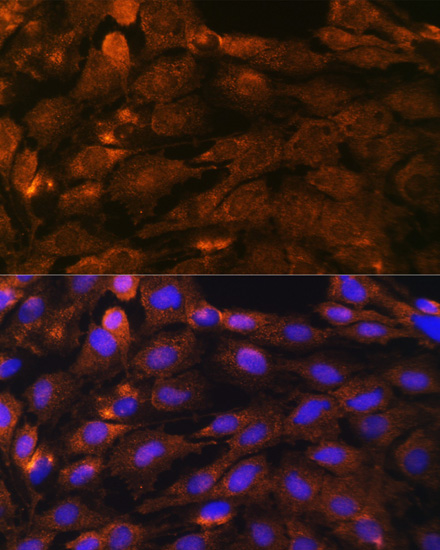 Immunofluorescence analysis of C6 cells using PTCH1 Polyclonal Antibody at dilution of  1:100. Blue: DAPI for nuclear staining.