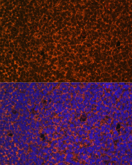 Immunofluorescence analysis of Mouse embryos cells using PTCH1 Polyclonal Antibody at dilution of  1:100. Blue: DAPI for nuclear staining.