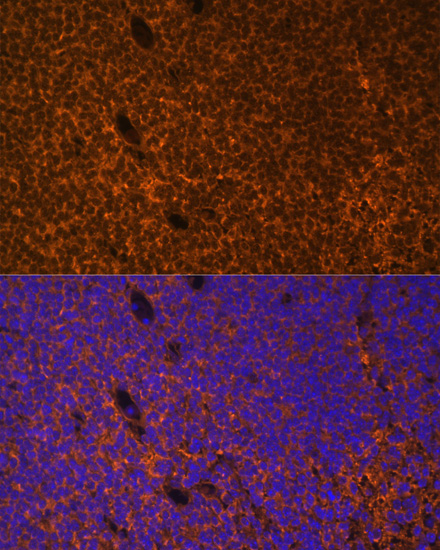 Immunofluorescence analysis of Mouse embryos cells using PTCH1 Polyclonal Antibody at dilution of  1:100. Blue: DAPI for nuclear staining.