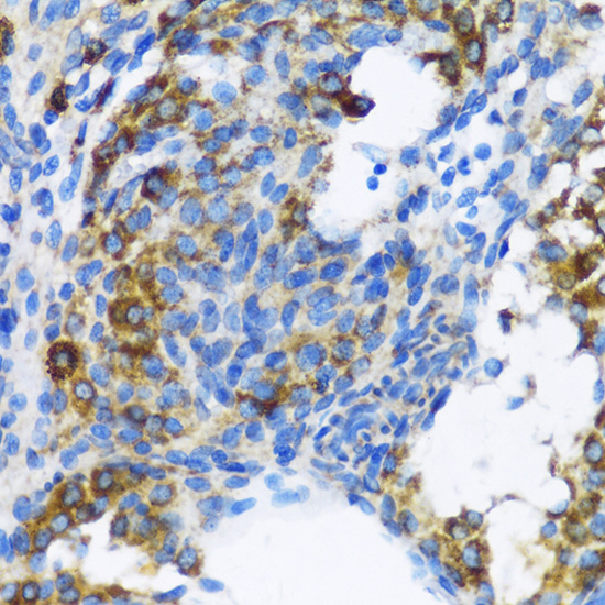 Immunohistochemistry of paraffin-embedded Rat ovary using PTCH1 Polyclonal Antibody at dilution of  1:100 (40x lens).