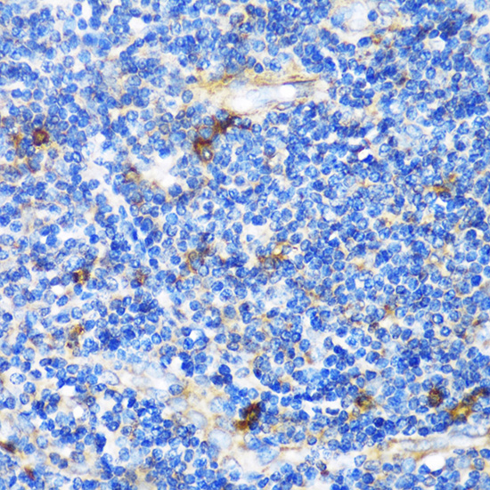Immunohistochemistry of paraffin-embedded Human tonsil using PTCH1 Polyclonal Antibody at dilution of  1:100 (40x lens).