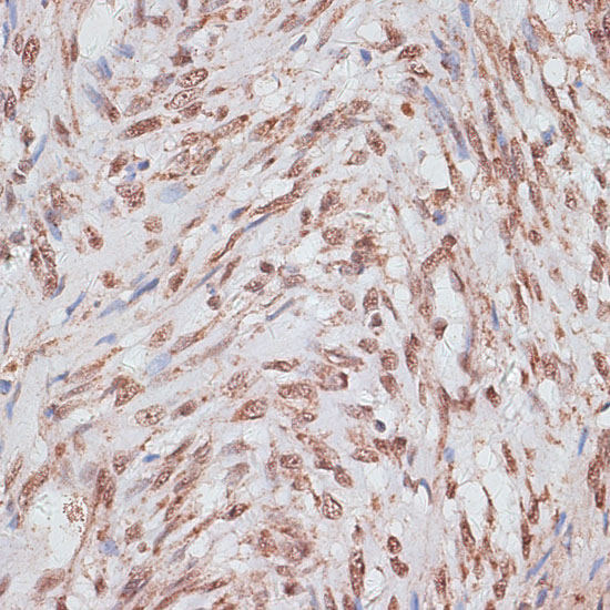 Immunohistochemistry of paraffin-embedded Human uterus using RPA1 Polyclonal Antibody at dilution of  1:100 (40x lens).