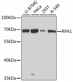 Western blot analysis of extracts of various cell lines using RPA1 Polyclonal Antibody at dilution of 1:3000.