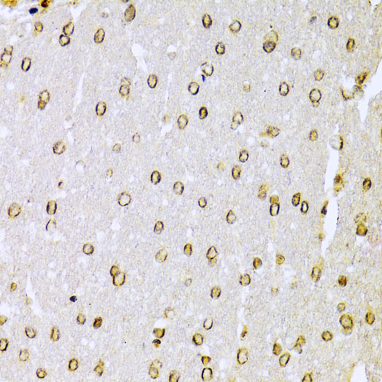 Immunohistochemistry of paraffin-embedded Rat brain using KU70 Polyclonal Antibody at dilution of  1:100 (40x lens).