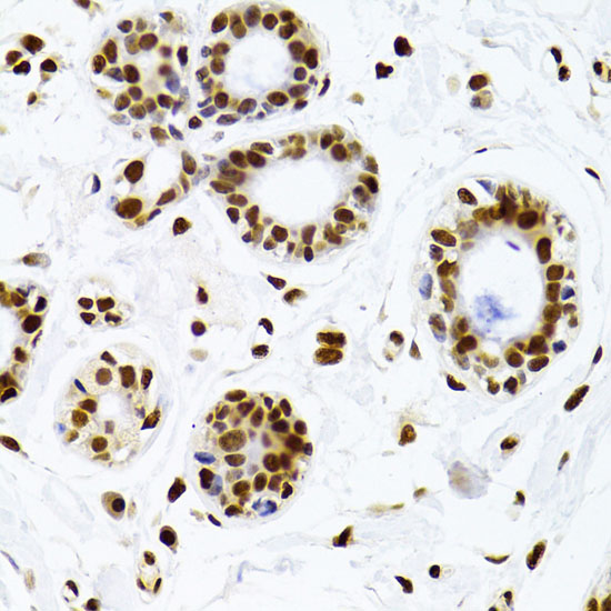 Immunohistochemistry of paraffin-embedded Human breast using KU70 Polyclonal Antibody at dilution of  1:100 (40x lens).