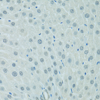 Immunohistochemistry of paraffin-embedded Rat liver using CEBPA Polyclonal Antibody at dilution of  1:100 (40x lens).