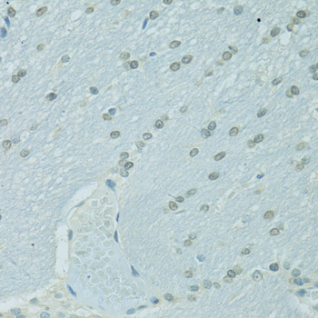 Immunohistochemistry of paraffin-embedded Rat brain using CEBPA Polyclonal Antibody at dilution of  1:100 (40x lens).