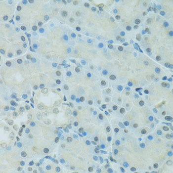 Immunohistochemistry of paraffin-embedded Rat kidney using CEBPA Polyclonal Antibody at dilution of  1:100 (40x lens).