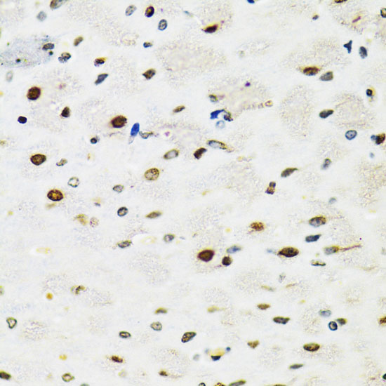 Immunohistochemistry of paraffin-embedded Rat brain using SFPQ Polyclonal Antibody at dilution of  1:100 (40x lens).