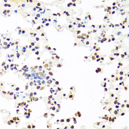 Immunohistochemistry of paraffin-embedded Mouse lung using SFPQ Polyclonal Antibody at dilution of  1:100 (40x lens).