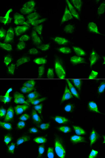 Immunofluorescence analysis of HeLa cells using TRAF6 Polyclonal Antibody