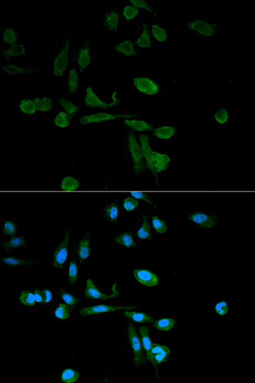 Immunofluorescence analysis of HeLa cells using SIRT7 Polyclonal Antibody