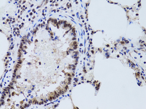 Immunohistochemistry of paraffin-embedded Rat lung using SIRT7 Polyclonal Antibody at dilution of  1:100 (40x lens).