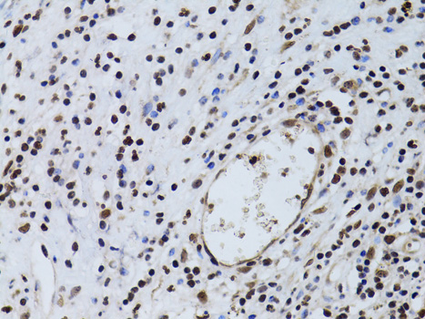 Immunohistochemistry of paraffin-embedded Human vermiform appendix using SIRT7 Polyclonal Antibody at dilution of  1:100 (40x lens).