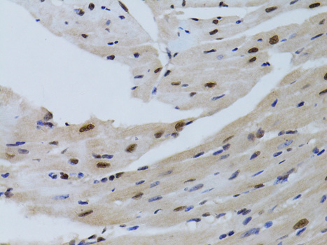 Immunohistochemistry of paraffin-embedded Mouse heart using SIRT7 Polyclonal Antibody at dilution of  1:100 (40x lens).