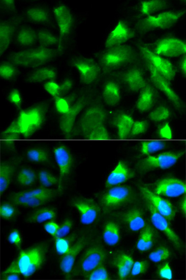 Immunofluorescence analysis of HeLa cells using SNAP25 Polyclonal Antibody