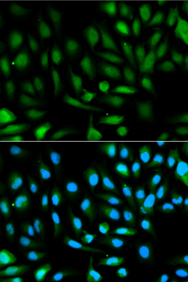 Immunofluorescence analysis of HeLa cells using PARK7 Polyclonal Antibody