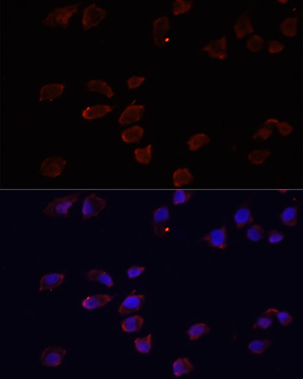 Immunofluorescence analysis of HeLa cells using ARF6 Polyclonal Antibody at dilution of  1:100. Blue: DAPI for nuclear staining.