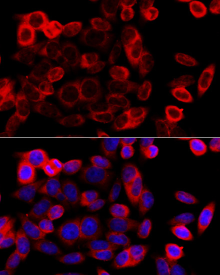 Immunofluorescence analysis of HeLa cells using HSP90B1 Polyclonal Antibody at dilution of  1:100 (40x lens). Blue: DAPI for nuclear staining.