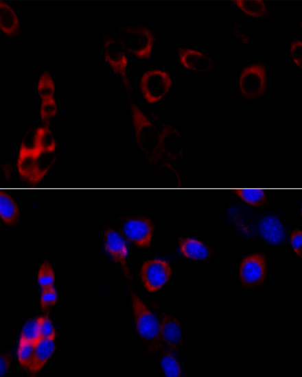 Immunofluorescence analysis of NIH/3T3 cells using HSP90B1 Polyclonal Antibody at dilution of  1:100 (40x lens). Blue: DAPI for nuclear staining.