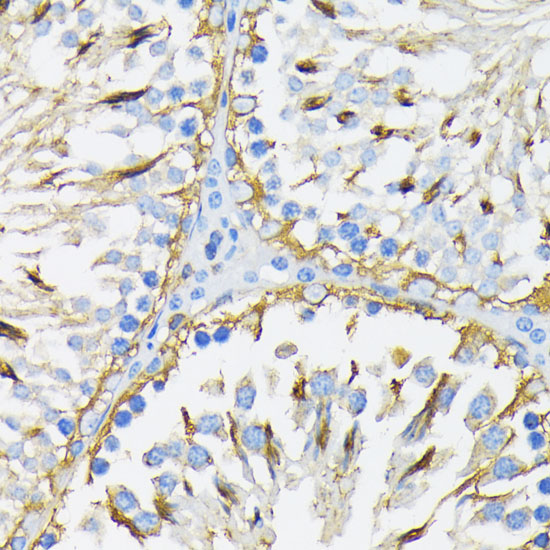 Immunohistochemistry of paraffin-embedded Rat testis using HSP90B1 Polyclonal Antibody at dilution of  1:200 (40x lens).