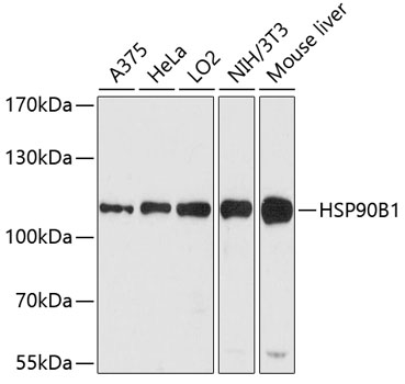 Western blot analysis of extracts of various cell lines using HSP90B1 Polyclonal Antibody at dilution of 1:1000.