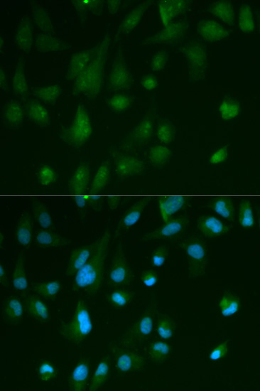 Immunofluorescence analysis of HeLa cells using ARRB1 Polyclonal Antibody
