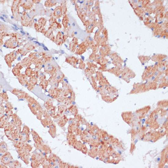 Immunohistochemistry of paraffin-embedded Rat heart using ARRB1 Polyclonal Antibody at dilution of  1:100 (40x lens).