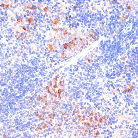 Immunohistochemistry of paraffin-embedded Mouse spleen using ARRB1 Polyclonal Antibody at dilution of  1:100 (40x lens).