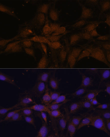 Immunofluorescence analysis of C6 cells using YAP1 Polyclonal Antibody at dilution of  1:100. Blue: DAPI for nuclear staining.