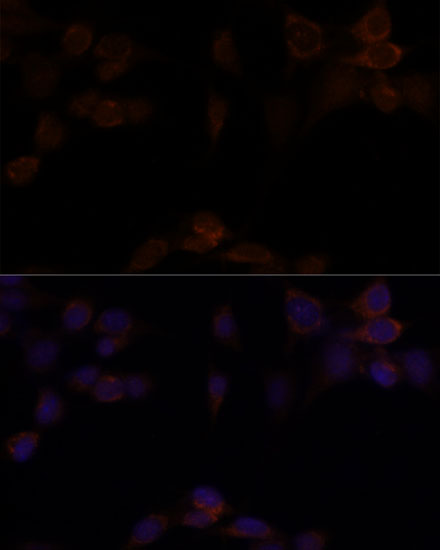 Immunofluorescence analysis of NIH/3T3 cells using YAP1 Polyclonal Antibody at dilution of  1:100. Blue: DAPI for nuclear staining.