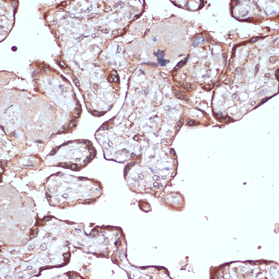 Immunohistochemistry of paraffin-embedded Human placenta using YAP1 Polyclonal Antibody at dilution of  1:100 (40x lens).