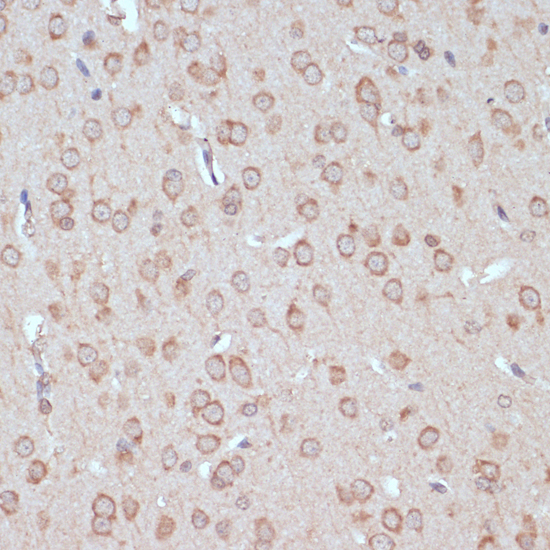 Immunohistochemistry of paraffin-embedded Rat brain using YAP1 Polyclonal Antibody at dilution of  1:100 (40x lens).