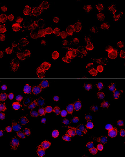 Immunofluorescence analysis of HeLa cells using CYP3A7 Polyclonal Antibody at dilution of  1:100 (40x lens). Blue: DAPI for nuclear staining.