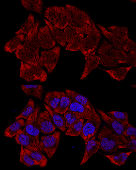 Confocal immunofluorescence analysis of HeLa cells using RPL8 Polyclonal Antibody at dilution of  1:200. Blue: DAPI for nuclear staining.