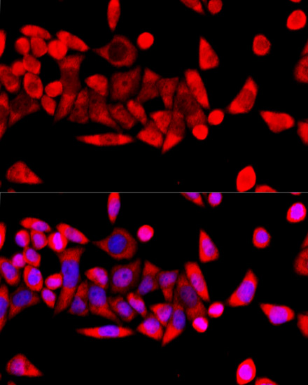 Immunofluorescence analysis of HeLa cells using RPL8 Polyclonal Antibody at dilution of  1:100 (40x lens). Blue: DAPI for nuclear staining.