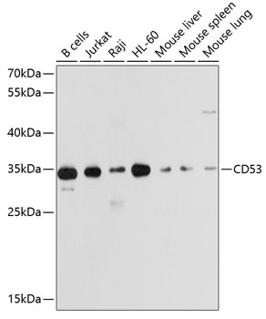 Western blot analysis of extracts of various cell lines using CD53 Polyclonal Antibody at dilution of 1:1000.