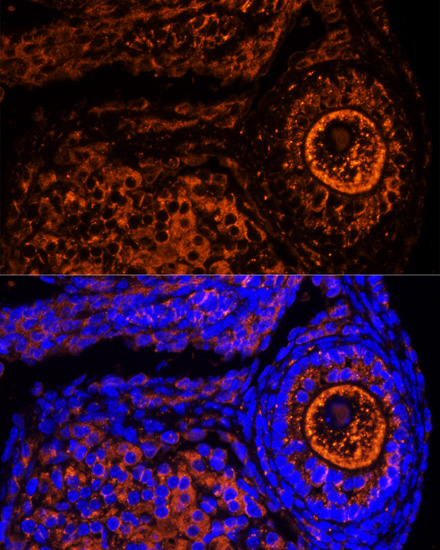 Immunofluorescence analysis of Mouse oophoroma cells using ZP2 Polyclonal Antibody at dilution of  1:100. Blue: DAPI for nuclear staining.