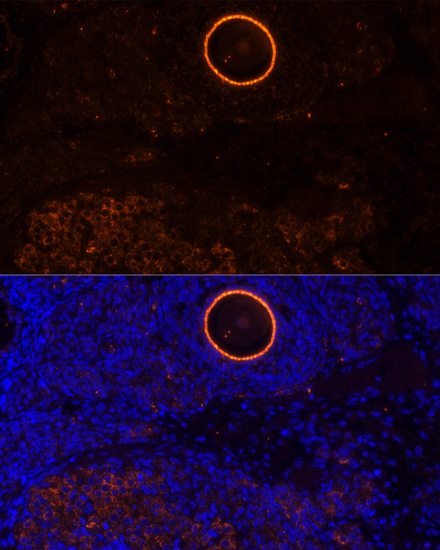Immunofluorescence analysis of Rat oophoroma cells using ZP2 Polyclonal Antibody at dilution of  1:100. Blue: DAPI for nuclear staining.