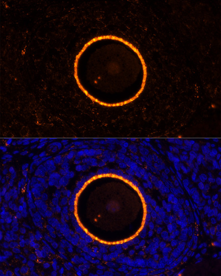 Immunofluorescence analysis of Rat oophoroma cells using ZP2 Polyclonal Antibody at dilution of  1:100. Blue: DAPI for nuclear staining.