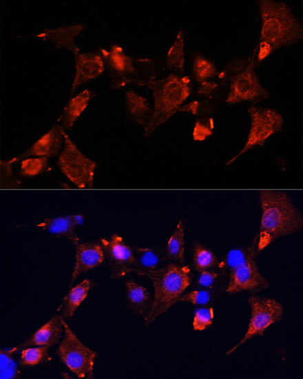 Immunofluorescence analysis of NIH-3T3 cells using CLUH Polyclonal Antibody at dilution of  1:100 (40x lens). Blue: DAPI for nuclear staining.