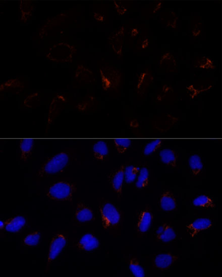 Immunofluorescence analysis of U-2 OS cells using ETHE1 Polyclonal Antibody at dilution of  1:100 (40x lens). Blue: DAPI for nuclear staining.
