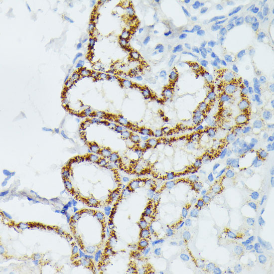 Immunohistochemistry of paraffin-embedded Mouse kidney using ETHE1 Polyclonal Antibody at dilution of  1:100 (40x lens).