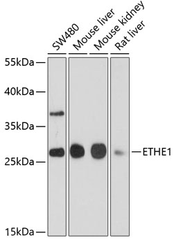 Western blot analysis of extracts of various cell lines using ETHE1 Polyclonal Antibody at dilution of 1:1000.