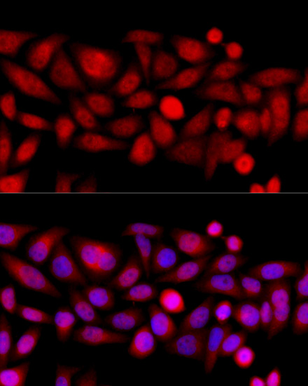 Immunofluorescence analysis of HeLa cells using KIF4A Polyclonal Antibody at dilution of  1:100 (40x lens). Blue: DAPI for nuclear staining.