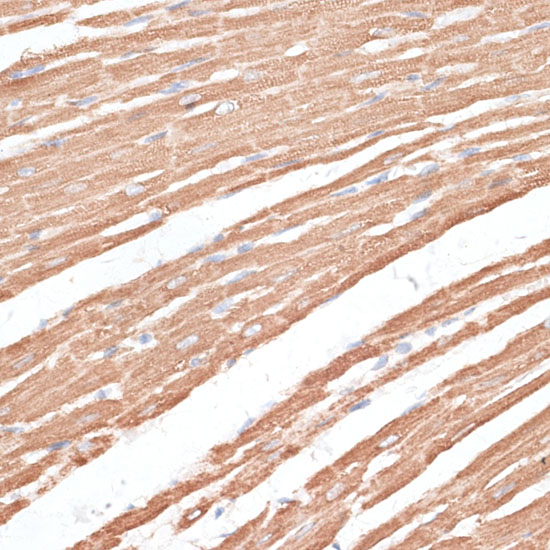 Immunohistochemistry of paraffin-embedded Rat heart using KIF4A Polyclonal Antibody at dilution of  1:100 (40x lens).