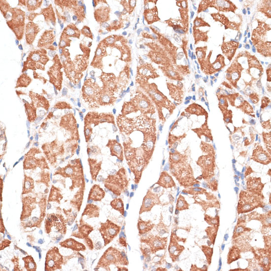 Immunohistochemistry of paraffin-embedded Human stomach using KIF4A Polyclonal Antibody at dilution of  1:100 (40x lens).